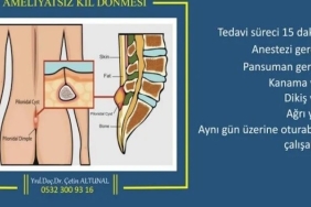 Kıl Dönmesi