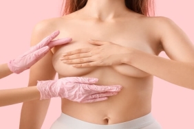 Meme Dikleştirme Estetiğine Talep Artıyor: İstanbul’da Op. Dr. Gökhan Semerci Öne Çıkıyor